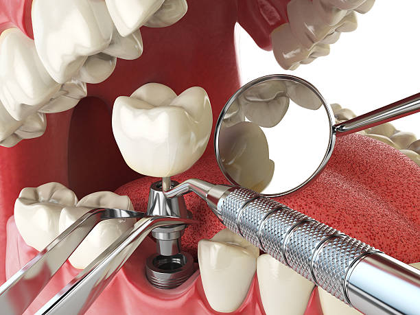 Best Urgent Dental Care for Toothache in Central, LA